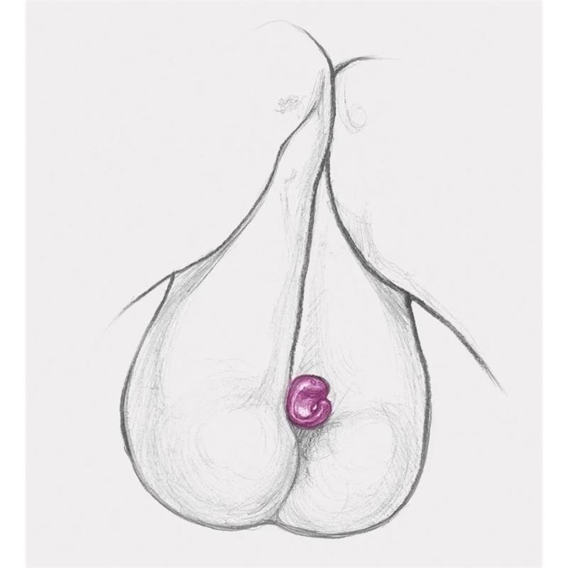 Anneau Gring XL Framboise Douce