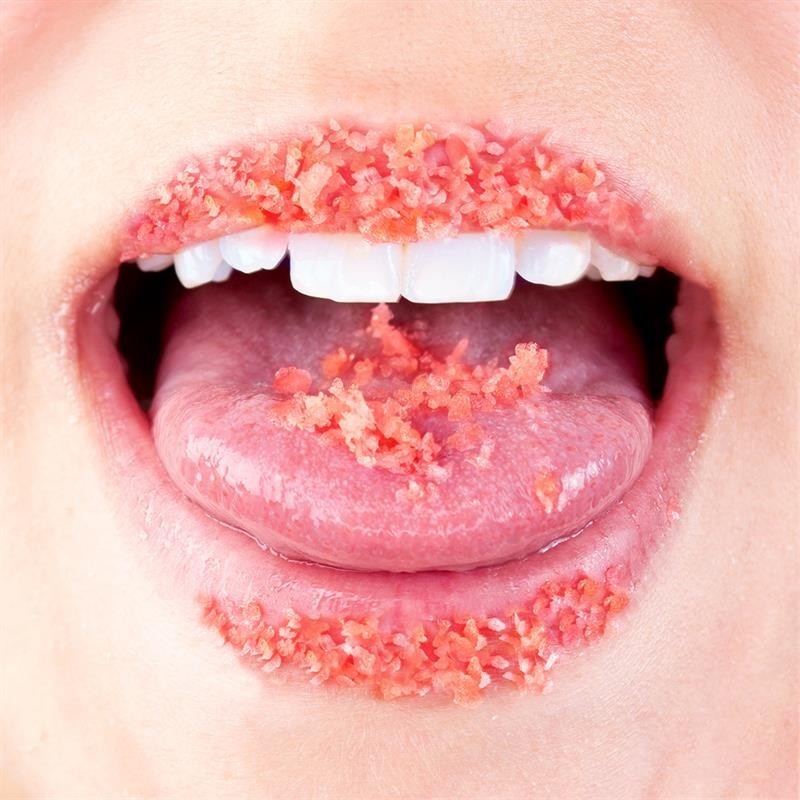 bonbons Explosivos sexe Oral Popping Bonbons unit gout Sandía